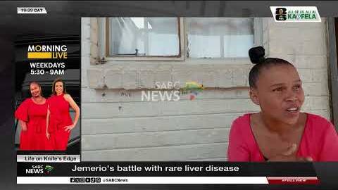 Three-year-old Jemerio's battle with rare liver disease