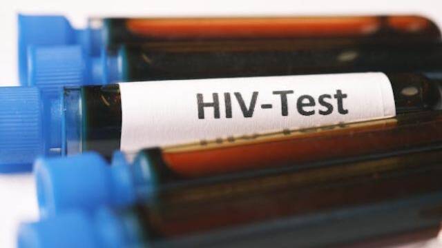 South African lab to produce new HIV treatment in Africa: Unitaid