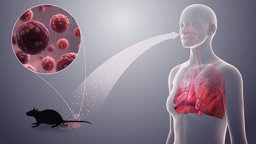 WHO praises SA&rsquo;s role in Hantavirus response