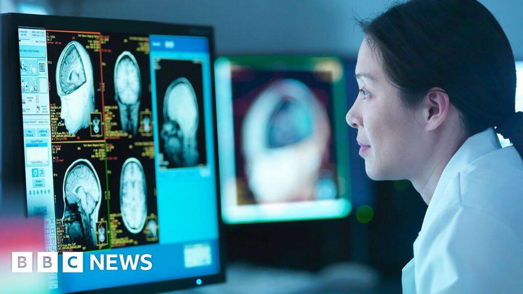 Menopause linked to Alzheimer's-like brain changes