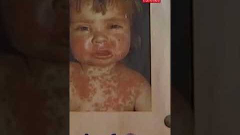 Parents and guardians urged to get children vaccinated