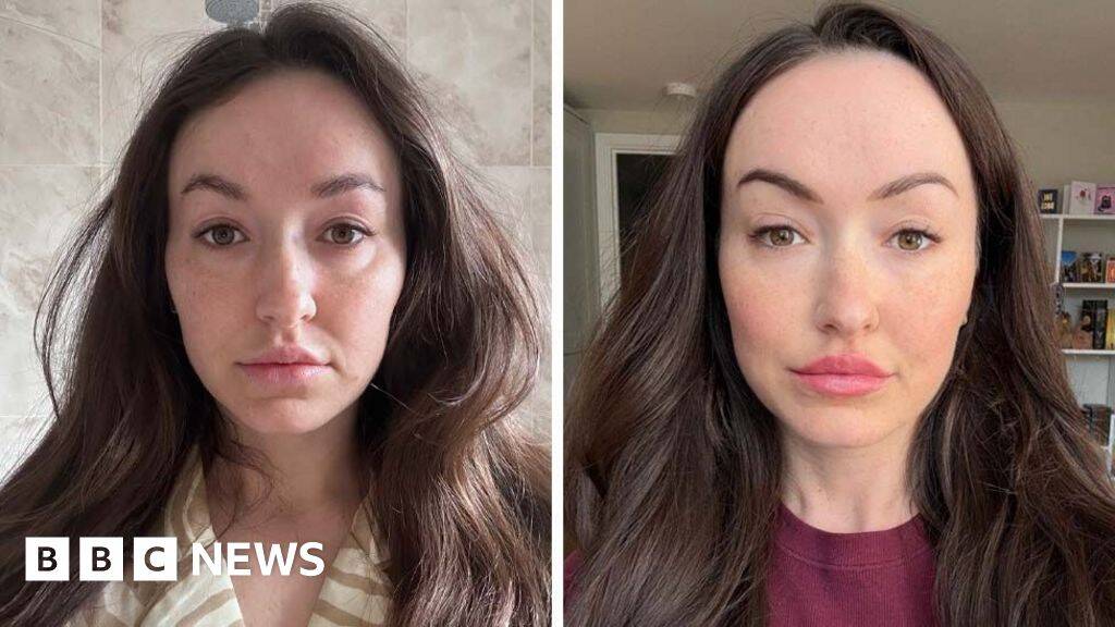 Is 'ferritin face' a real thing - and can you really spot low iron from looks?